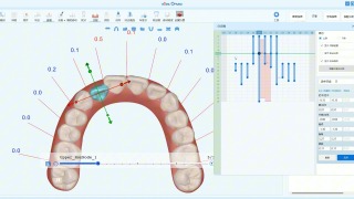 2026易美智汇贺岁大片即将发布 eSet New Staging（可视化分步设计）