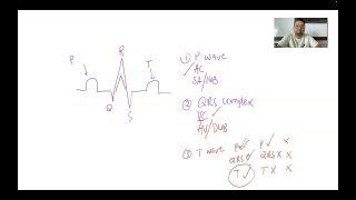 CARDIO Series: ECG (Electrocardiogram) - PART 1